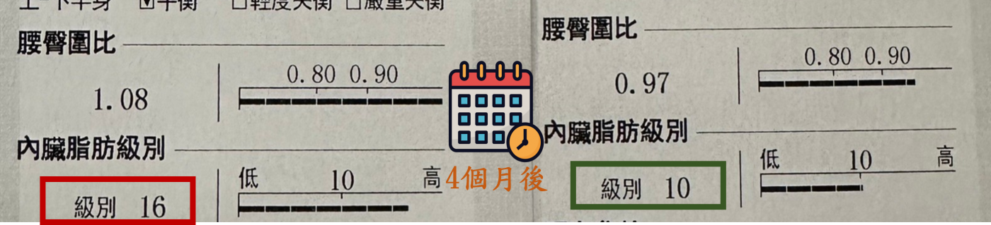 歷經四個月的胃肉毒減重療程，此為個案的腰臀圍比、內臟脂肪級別紀錄。