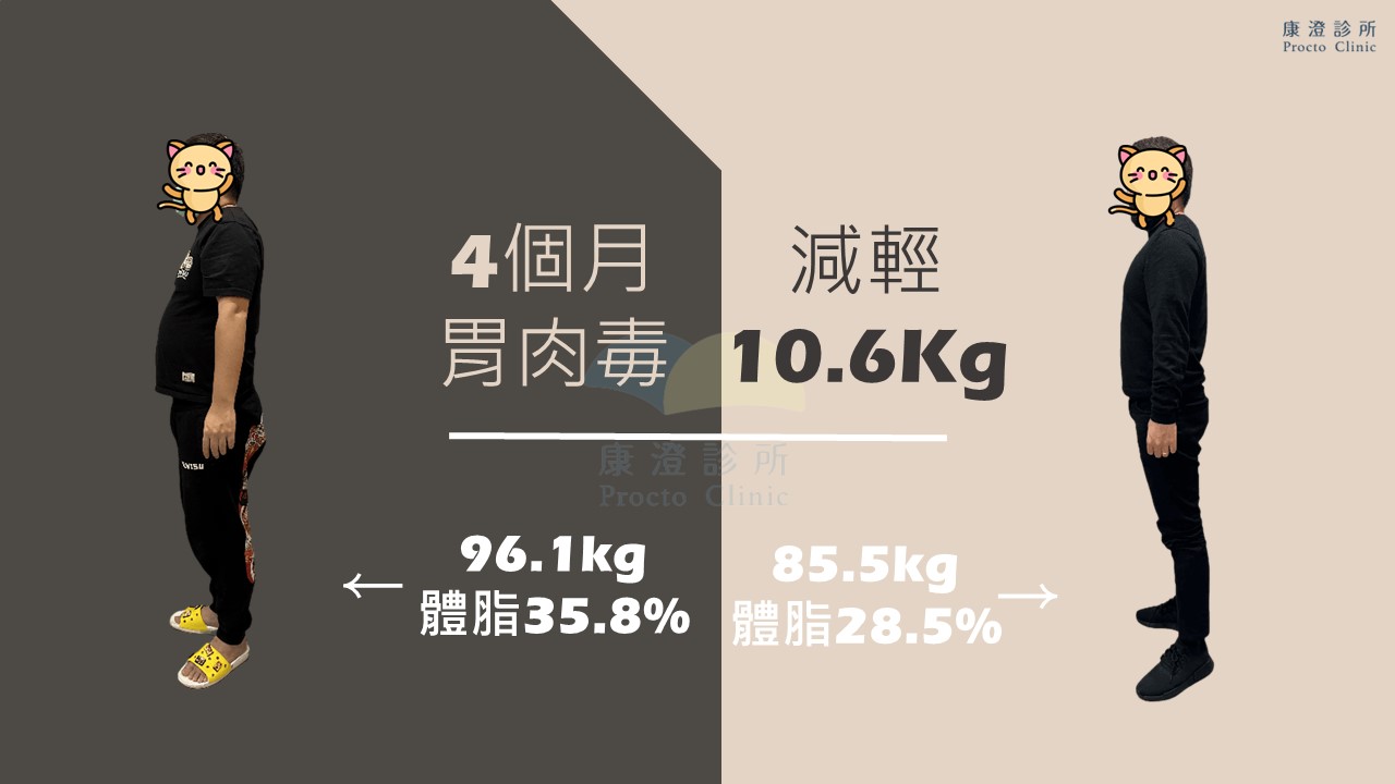 胃肉毒案例二