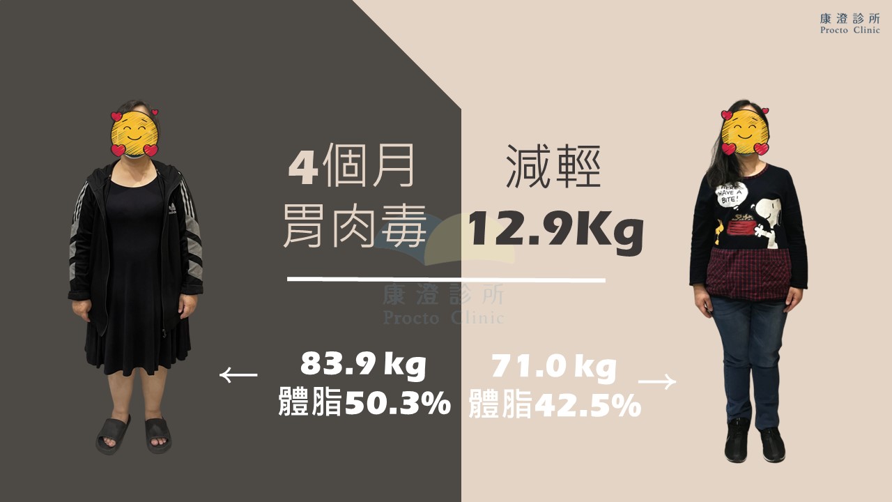 胃肉毒案例三